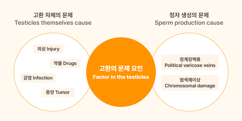 남성불임에 대한 이미지